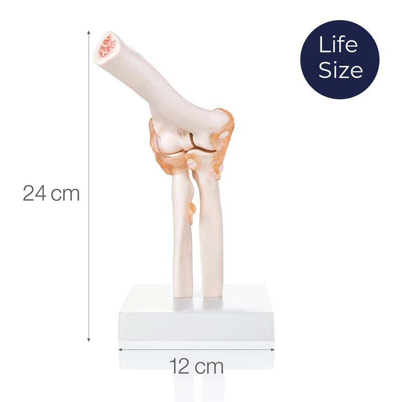 Life Size Elbow Joint Model